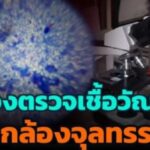 เครื่องตรวจเชื้อวัณโรคด้วยกล้องจุลทรรศน์