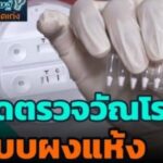 ชุดตรวจวัณโรคแบบผงแห้ง